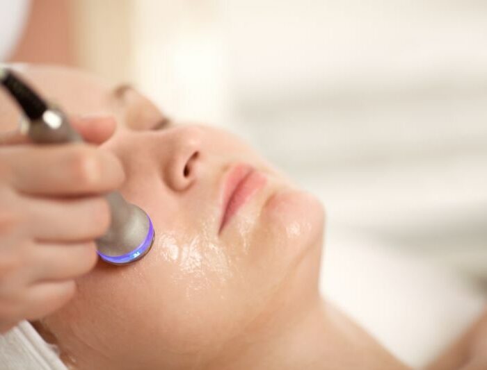 radiofrequency facials